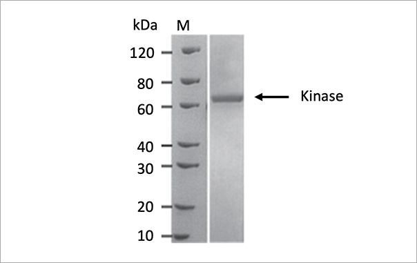 Sf9细胞成功表达Kinase，纯度95%，表达量10mg/L